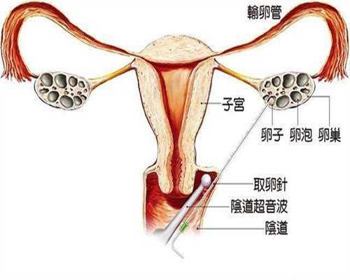 <b>韩国剧高鹰代孕：孕妇尿频的原因和应对方法</b>