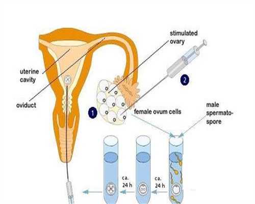 输卵管狭窄的部位是~供卵中介哪家靠谱代孕可以