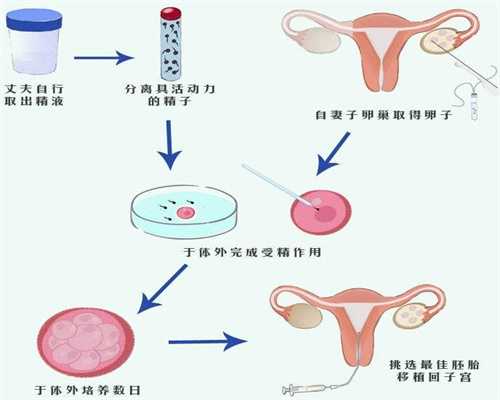 先天性卵巢发育不全综合征的治疗是,试管婴儿成