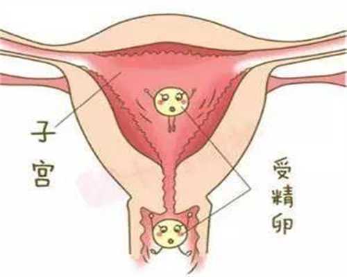 广州代孕-广州正规助孕医院-广州2021代孕要花多