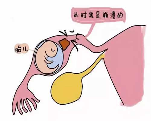 <b>广州代孕_广州有代孕价格_广州借卵生的孩子是亲</b>