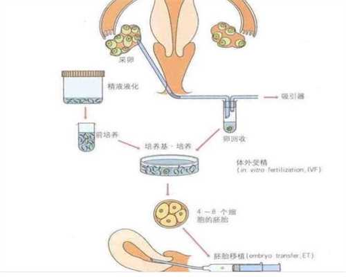 广州代孕_广州提供代孕服务_广州试管代孕代孕全