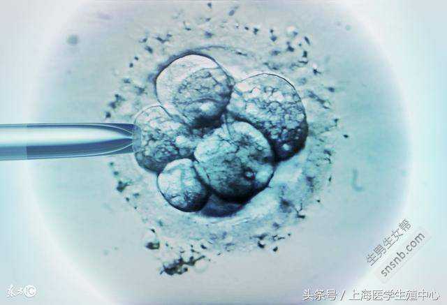 广州代生小孩包成功，【大连妇产医院供卵吗】所以姐妹们，宫腔积液可以排出