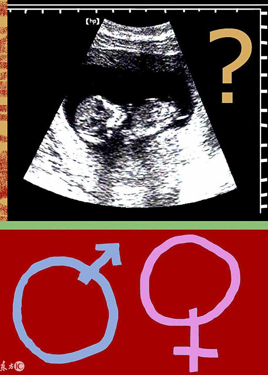 彩超胎儿性别鉴定方法